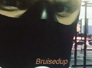 Bruisedup