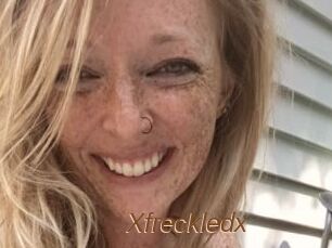 Xfreckledx